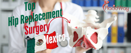 Why Mexico is a Top Destination for Hip Replacement Surgery?